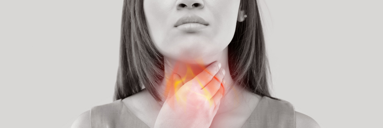 Home remedies for hearburn