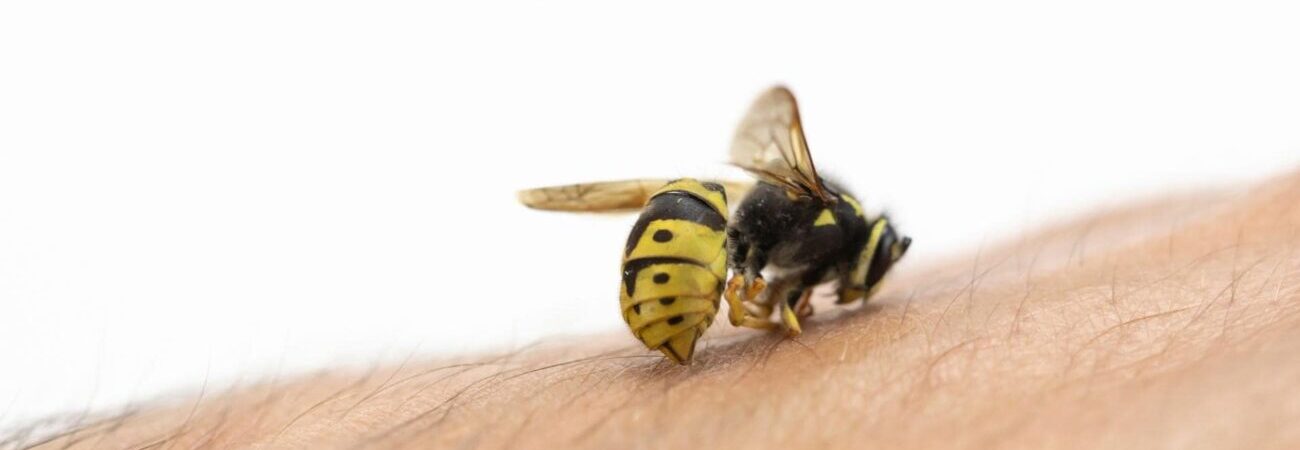 Bee sting treatment